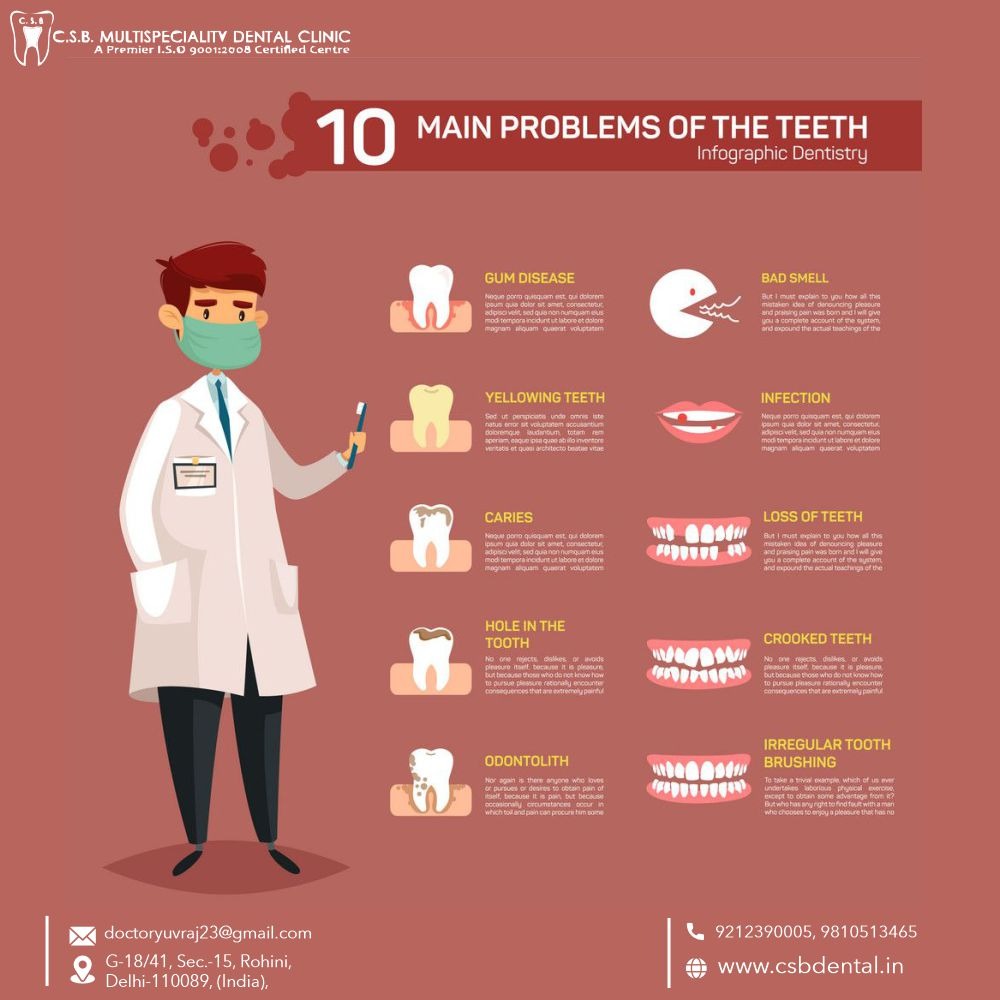 Root Canal in Rohini sector 15, Delhi